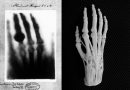 3D печать в медицине станет такой же рутиной, как рентген? 3D печать в медицине станет такой же рутиной, как рентген?
