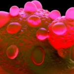 Жидкостный тест на рак мочевого пузыря выйдет в 2022 году