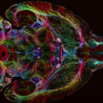 Исследователи оснастили МРТ-томограф 9,4 Тл сверхмощными катушками для лучшего понимания неврологических заболеваний