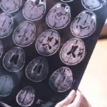 Новое исследование с применением МРТ проливает свет на особенности мозга долгожителей