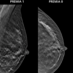 Новые возможности в маммографии и интервенционные технологии от Siemens Healthineers